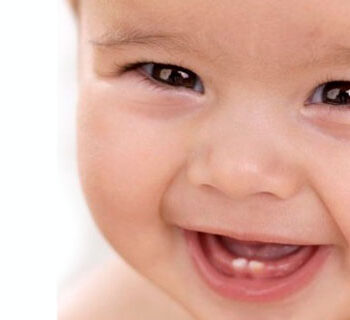 Самі випадуть: стоматологи «Фенікс-Дент» розповіли найпоширеніші міфи про молочні зуби
