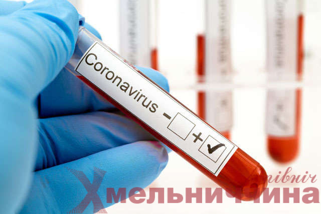 Шепетівський центр ПМСД: яка ситуація з коронавірусом у районі
