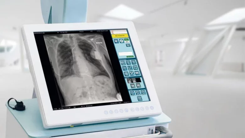 Славутська багатопрофільна лікарня отримала пересувний рентген-апарат: хто благодійник