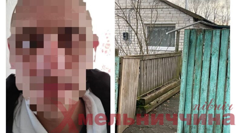 На Славутчині 34-річний чоловік жорстоко вбив свою сусідку