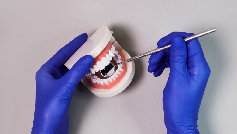 Шепетівська стоматологиня про причини та наслідки зубного нальоту