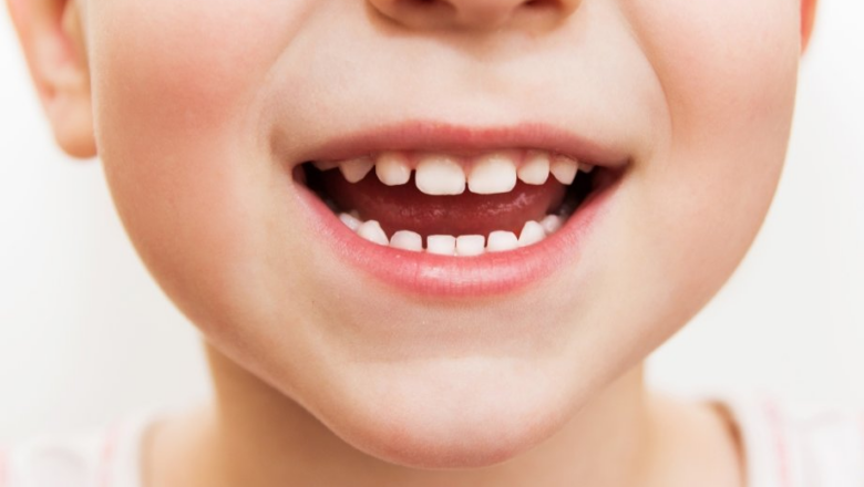 Надія Августінова: як подбати про кожен зубчик, аби у дитини не було карієсу