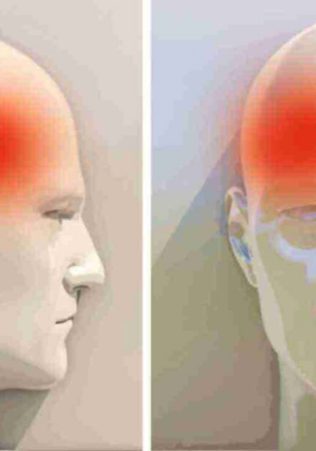 Важливе про головний біль розповіла шепетівська терапевтка