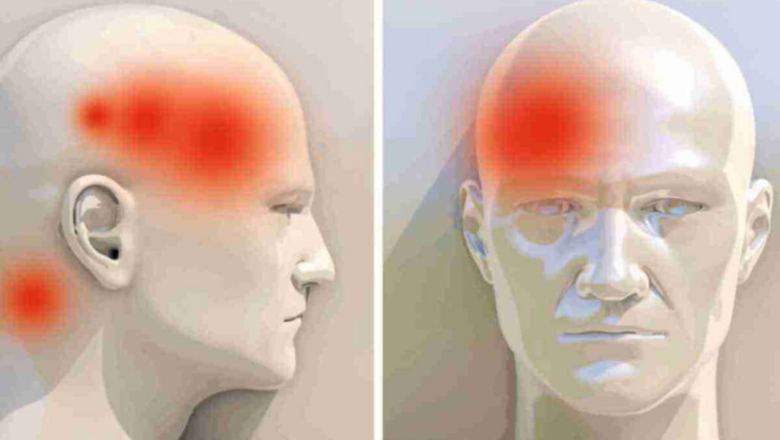 Важливе про головний біль розповіла шепетівська терапевтка