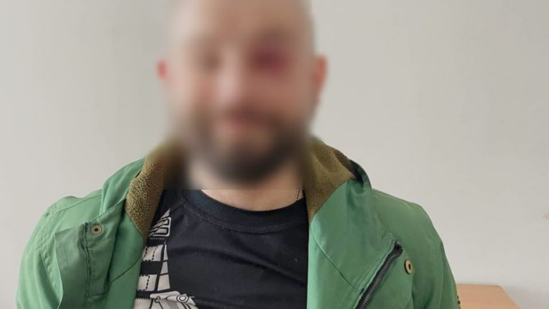 Чоловіка з Шепетівщини судитимуть за підозрою у зберіганні наркотиків