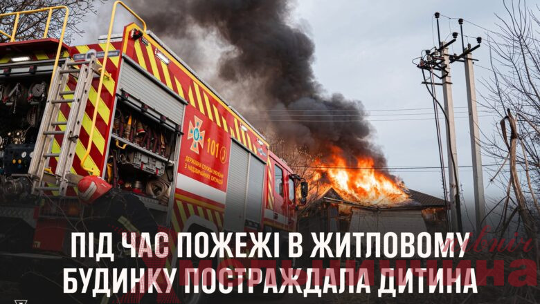 На Хмельниччині під час пожежі постраждала дитина