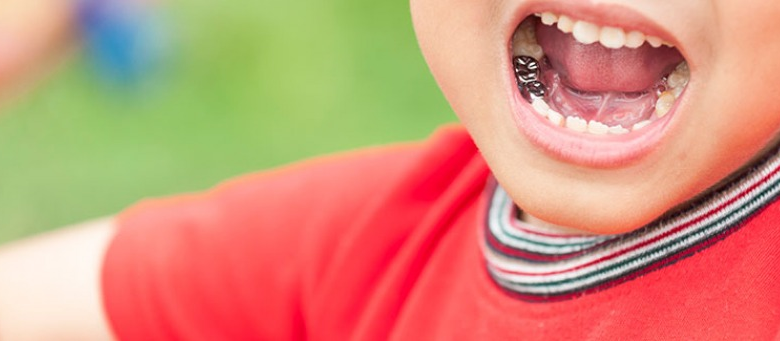 Коронки на молочні зуби: необхідність чи надмірність? Експертний погляд на збереження дитячої посмішки. Говоримо з Надією Августіновою, стоматологинею “Фенікс-Дент”