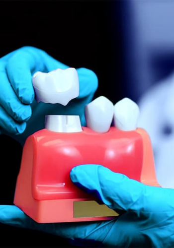 Коронки на молочні зубки: про  “закулісся” медичного процесу розповідає лікарка Надія Августінова