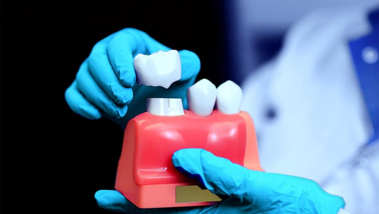 Коронки на молочні зубки: про  “закулісся” медичного процесу розповідає лікарка Надія Августінова